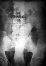 Dildoa in the rectum
