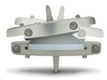 ProDisc L