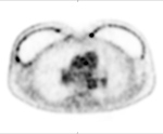 Figure 19B