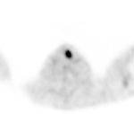 Figure 20A