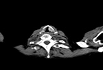 Figure 20B