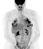 Figure 21A