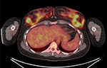 Figure 21D