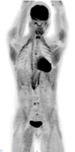 Figure 24A