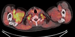 Figure 24B