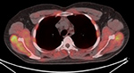 Figure 24D