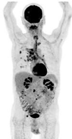 Figure 25D