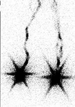 Figure 26A