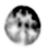 Figure 27A