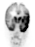 Figure 27B