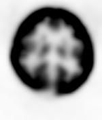 Figure 27E