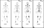 Figure 28A
