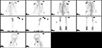 Figure 28B