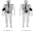 Figure 30A