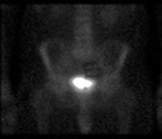 Figure 31
