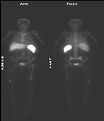 Figure 32A