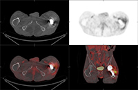 Figure 33