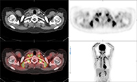 Figure 34