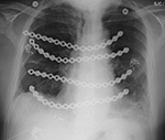 Figure 35A